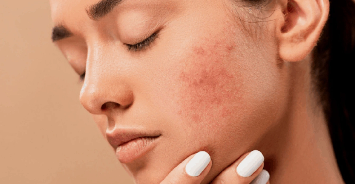 Skin Disease and Dental Health inblog
